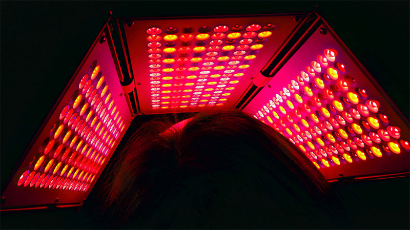 Triwings utilisation traitement phototherapie visage LED
